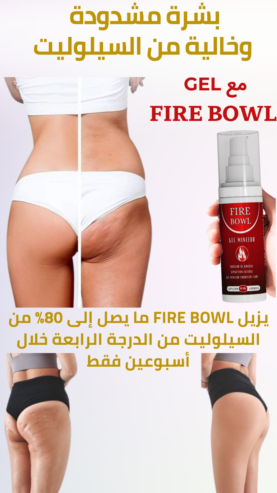 CELLULITE